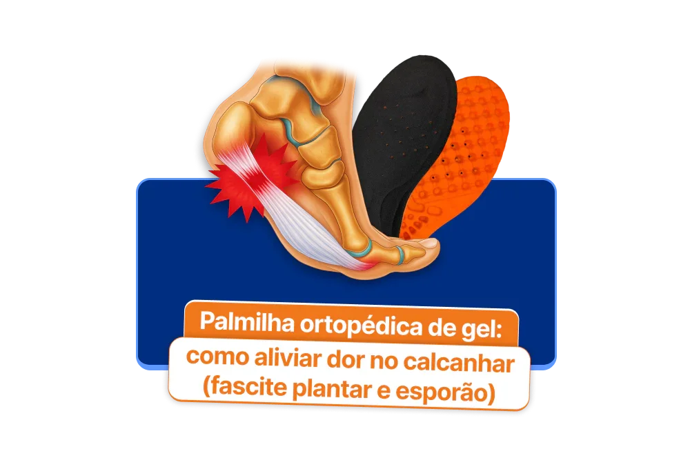 Palmilha ortopédica de gel: como aliviar dor no calcanhar (fascite plantar e esporão)