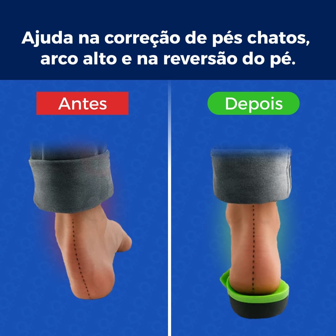 Palmilha com elevação para Pisada Irregular - Vitalis Sport™